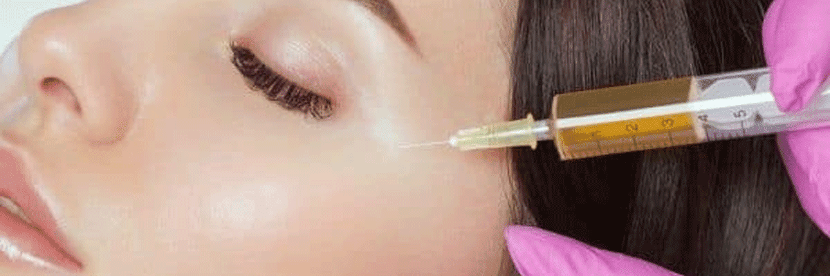 Face Platelet Rich Plasma