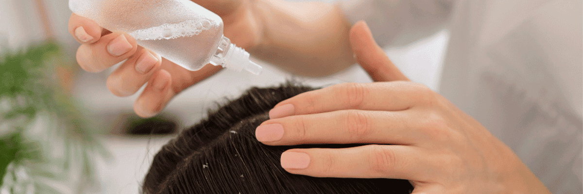 Hair Fall Treatment
