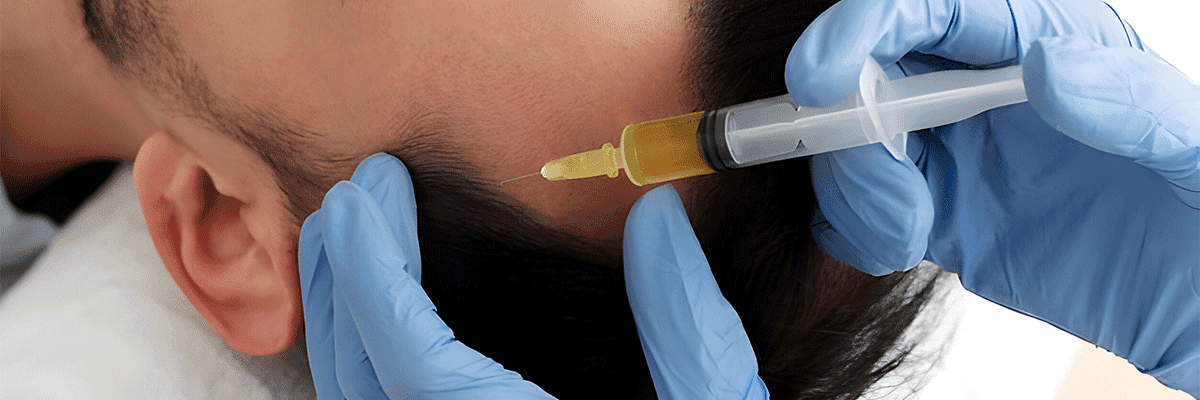 Hair Platelet Rich Plasma